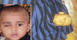 তবে কি বিনাচিকিৎসায় অন্ধ হবে চক্ষু ক্যান্সারে আক্রান্ত কুমিল্লার