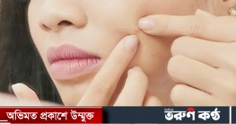 ব্রণ, অ্যাকনে ও শুষ্কতা সমাধানে কী করা উচিত