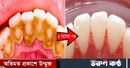 পান খেয়ে দাঁতে দাগ পড়েছে, তিন মিনিটেই হবে ঝকঝকে সাদা