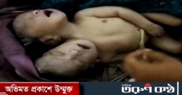 শার্শায় দুই মাথা নিয়ে শিশুর জন্ম, পরে মৃত্যু