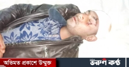 তামাবিলে বর্ডারের চাঁদাবাজ সন্ত্রাসী হামলার শিকার