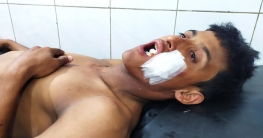 লাকসামে প্রতিবন্ধী যুবককে নির্যাতনের অভিযোগ