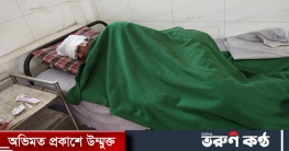 ভাতিজার ধারালো অস্ত্রের কোপে চাচী হাসপাতালে