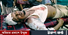 বরগুনা আমতলীতে দোকানের পজেশন নিয়ে সংঘর্ষে হাতুরী পেটায় ৪ জন আহত