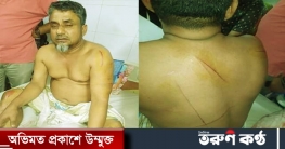 গাজীপুরে আইনজীবী সন্ত্রাসী হামলার শিকার: আসামি ধরাছোঁয়ার বাইরে