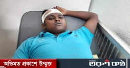 পুরাতন ফ্যান ভেঙে জবিতে কর্মচারী আহত
