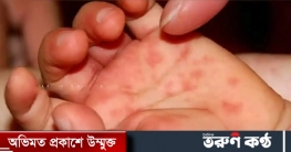 মাঙ্কিপক্সের পর এবারে ভারতে টম্যাটো ফ্লু আতঙ্ক