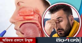 সর্দিতে নাক বন্ধ হলে স্বস্তি পেতে যা করবেন