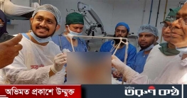 শিশুর ভেতর আরেক শিশু, সফলভাবে অপসারণ করলেন একদল চিকিৎসক