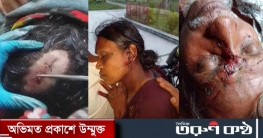 রাঙ্গাবালীতে জমি নিয়ে বিরোধ নারী সহ উভয় পক্ষের ১২ জনকে কুপিয়ে যখম রাঙ্গাবালীতে জমি নিয়ে বিরোধ নারী সহ উভয় পক্ষের ১২ জনকে কুপিয়ে যখম
