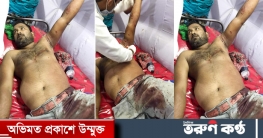 গাজীপুরে বঙ্গবন্ধু সাফারী পার্কে বাঘের থাবায় আহত কর্মচারী