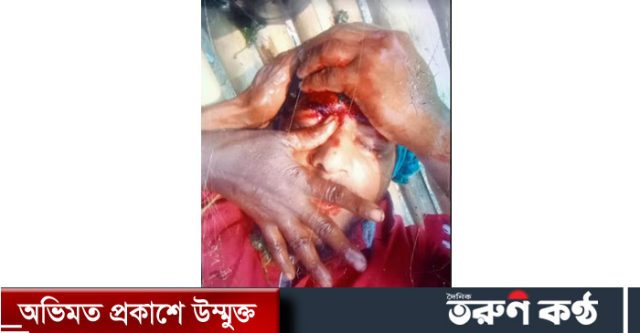 লাকসামে ছাগলে ধান খাওয়ার প্রতিবাদ করায় সন্ত্রাসীরা পিটিয়েছে যুবলীগ নেতাকে