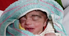 ফুটফুটে নবজাতককে হাসপাতালে রেখে পালালেন মা, দত্তকে আগ্রহী অর্ধশত