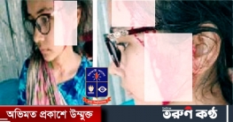 তুচ্ছ ঘটনায় ঢাবি ছাত্রীর মাথা ফাটালেন দুর্বৃত্তরা