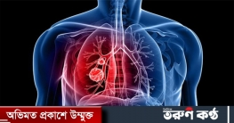 যে পাঁচ খাবার খেলে হতে পারে ক্যান্সার