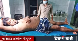 শরীয়তপুরে হত্যার উদ্দেশ্যে বালুব্যবসায়ীকে কুপিয়েছে সন্ত্রাসীরা