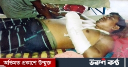 মধুখালীতে তুচ্ছ ঘটনায় পিটিয়ে হত্যা চেষ্টার অভিযোগ, থানায় মামলা মধুখালীতে তুচ্ছ ঘটনায় পিটিয়ে হত্যা চেষ্টার অভিযোগ, থানায় মামলা