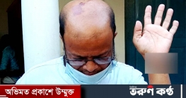মাদরাসার সুপারকে পেটাল অফিস সহকারী