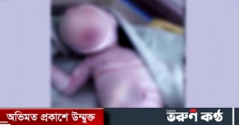 চট্টগ্রামে বিরল চর্মরোগের কারণে ডোরাকাটা শিশুর জন্ম