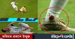 পা থেকে ঝরছিল রক্ত, তবুও থামেননি মেসি