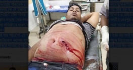 কুমিল্লায় চাঁদা না দেওয়ায় ব্যবসায়ি কে ছুরিকাঘাত